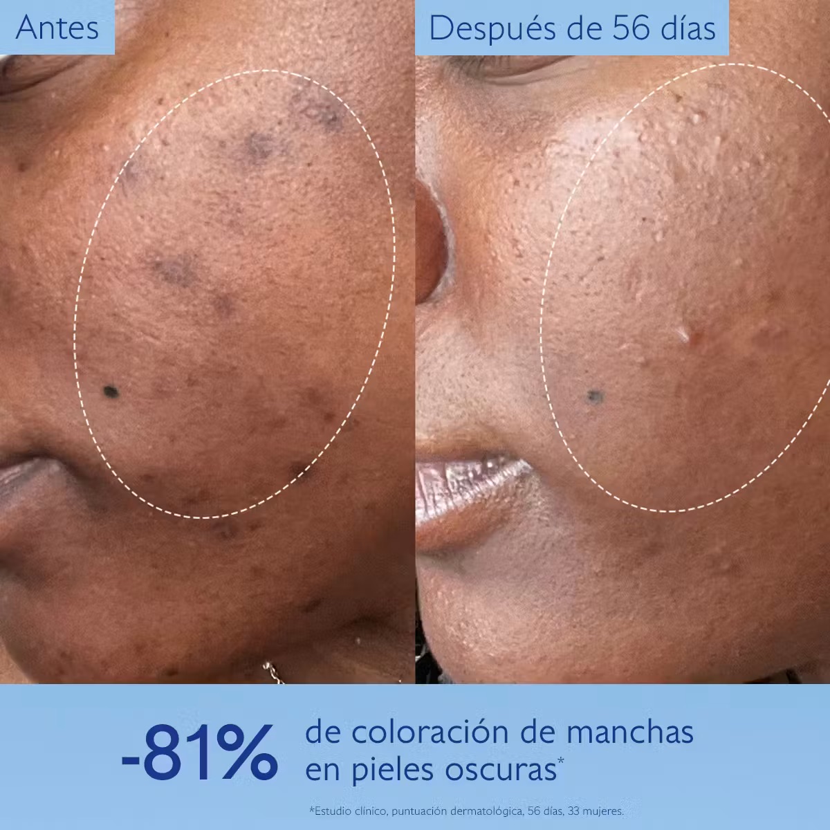 CAUDALIE Vinoperfect Serum Abtimanchas - Imagen 10